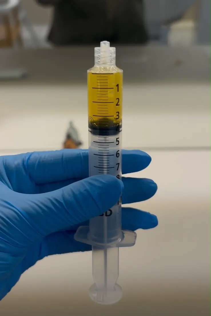 Mão com luva segurando uma seringa com plasma rico em plaquetas